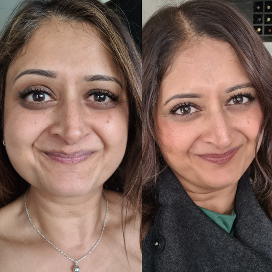 Asha's Story