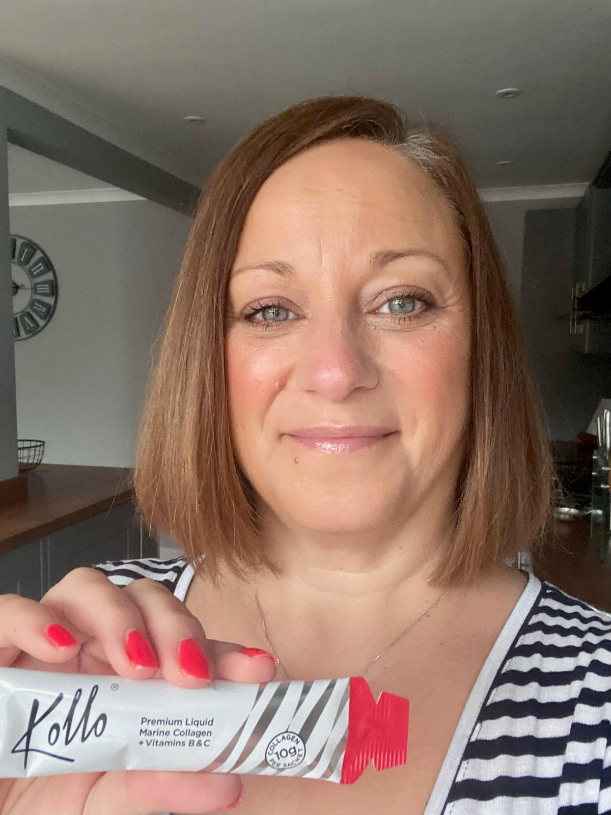 My Kollo Journey // Connie