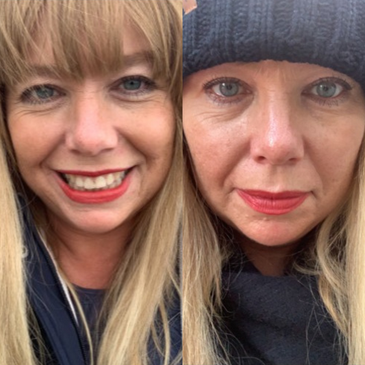 Kirsteen's Story