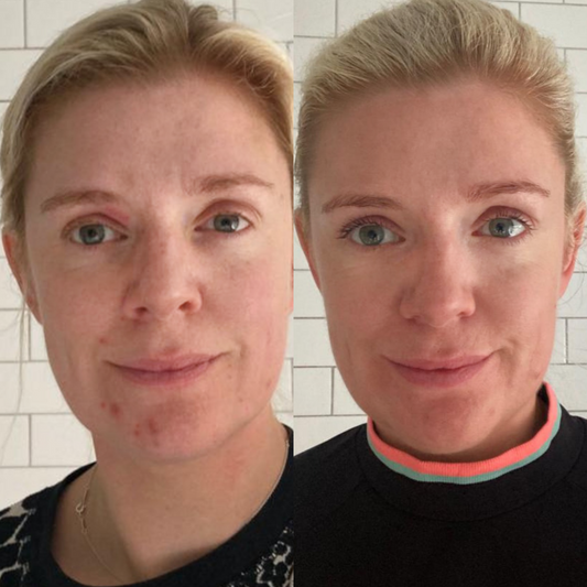  Joanne's Story 