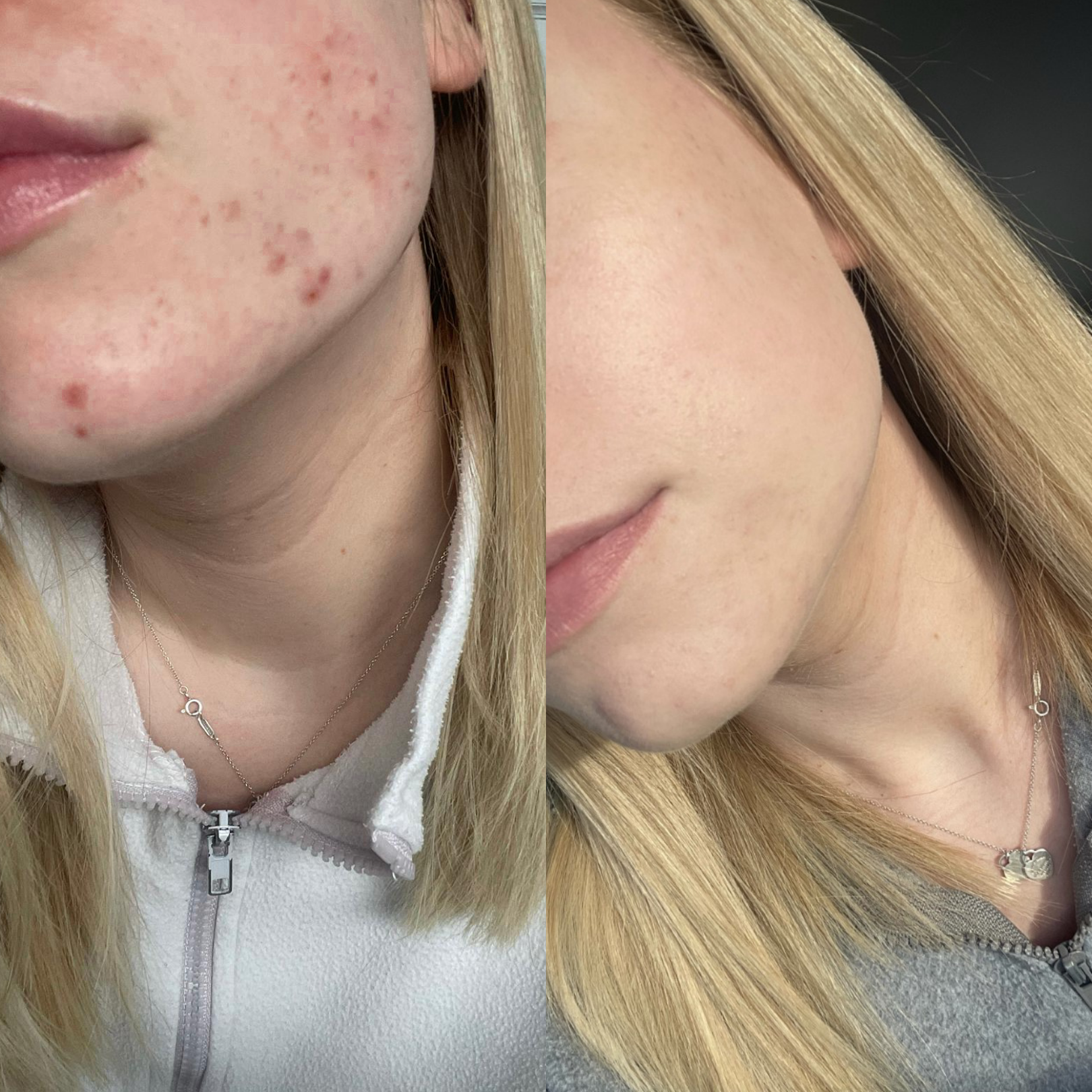 Melissa's Story