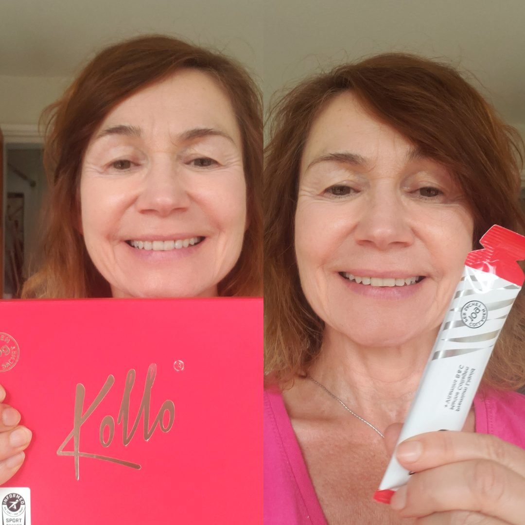 My Kollo Journey // Cathy