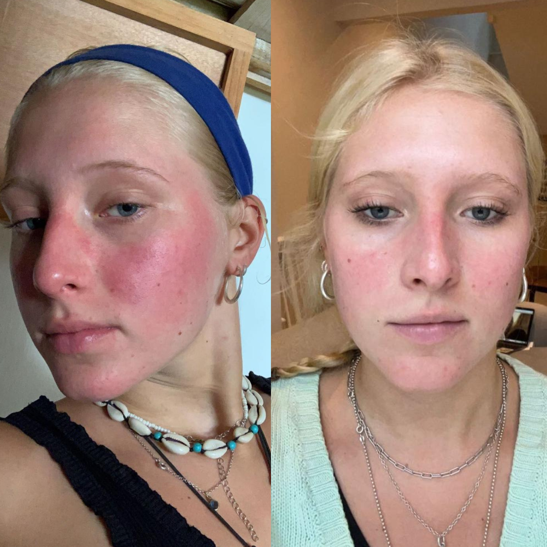 My Kollo Journey // Francesca