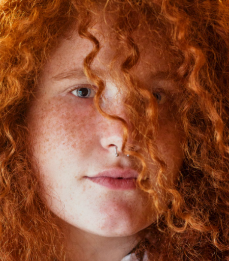 Is marine collagen good for rosacea?