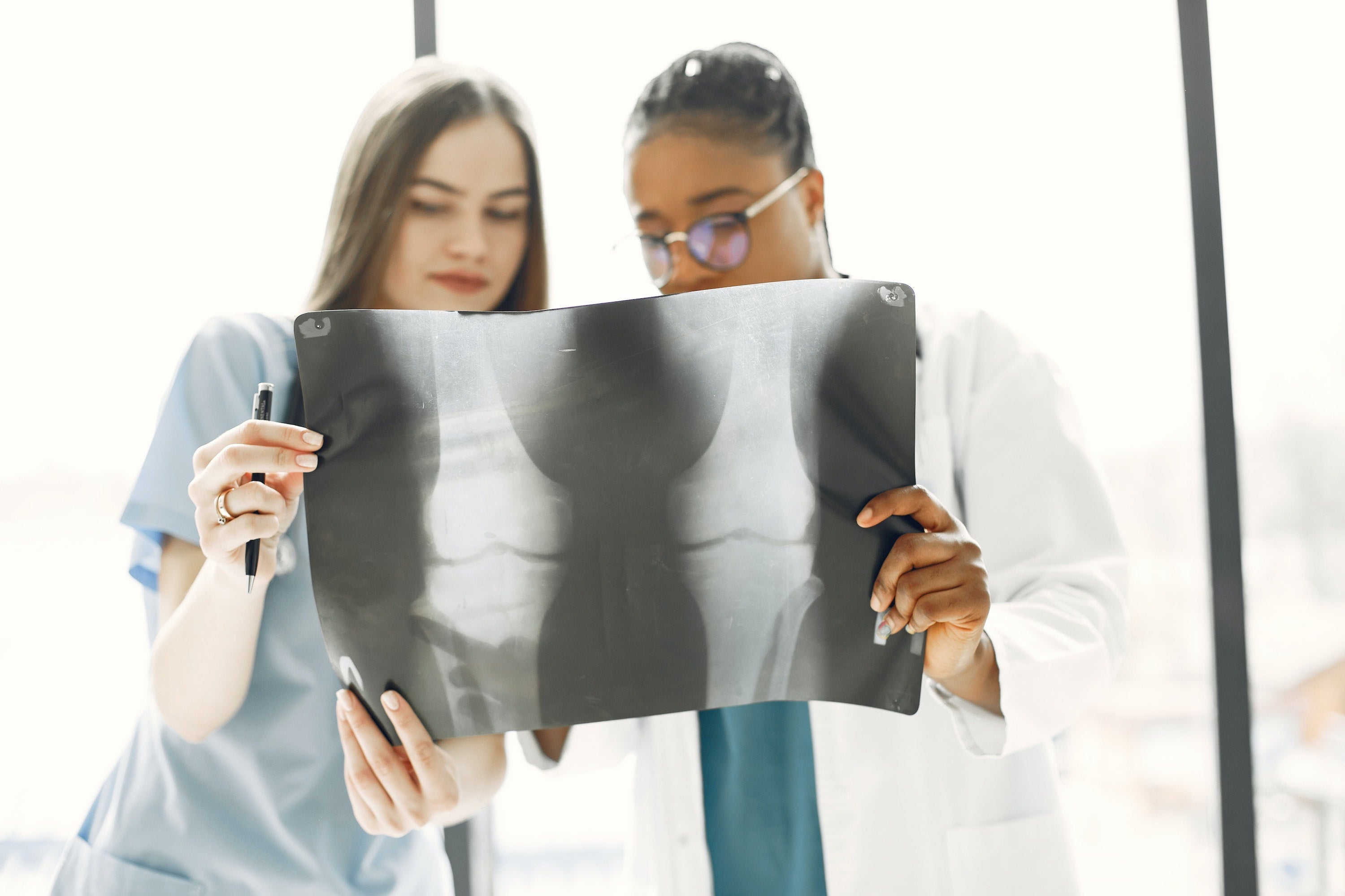 What type of collagen is in bones?