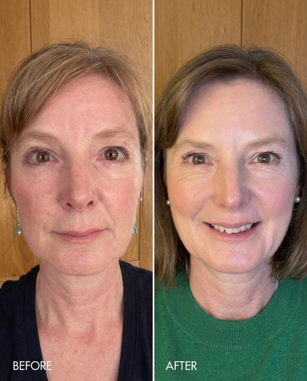 Kollo® Premium Liquid Marine Collagen Drink