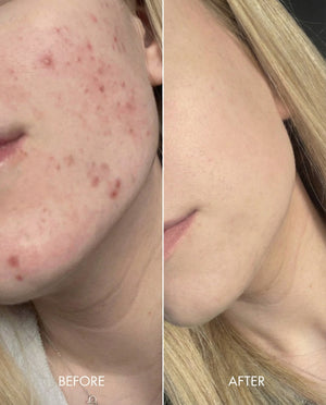 Kollo® Premium Liquid Marine Collagen Drink