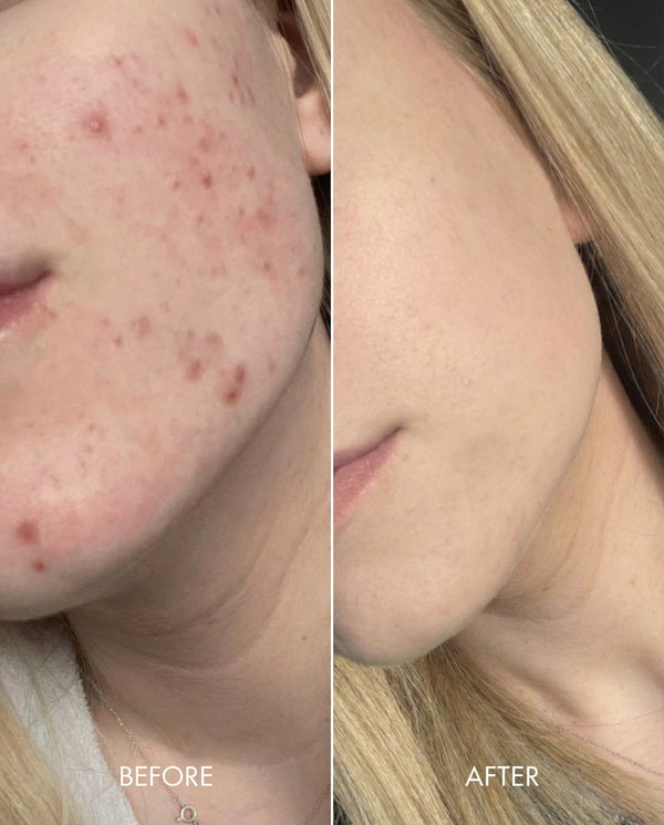 Kollo® Premium Liquid Marine Collagen Drink