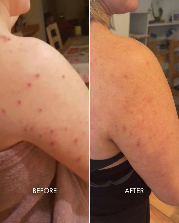 Kollo® Premium Liquid Marine Collagen Drink