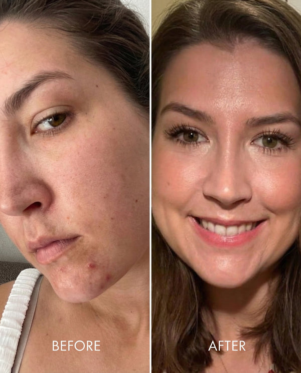 Kollo® Premium Liquid Marine Collagen Drink