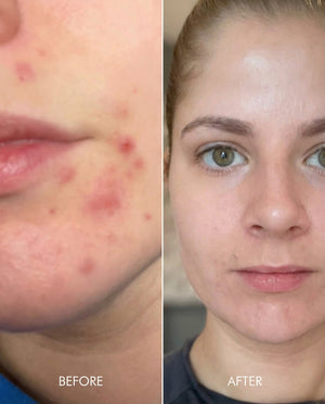 Kollo® Premium Liquid Marine Collagen Drink